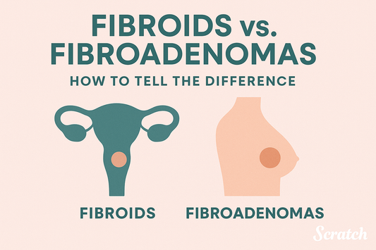 Fibroids vs. Fibroadenomas: How to Tell the Difference
